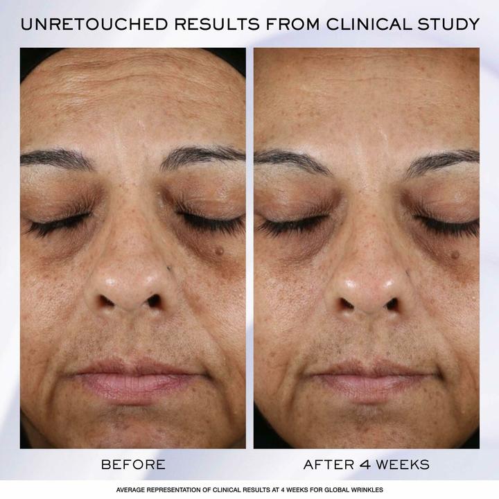 Immagine prodotto Lancôme Renergy (50 ml, Crema da giorno)