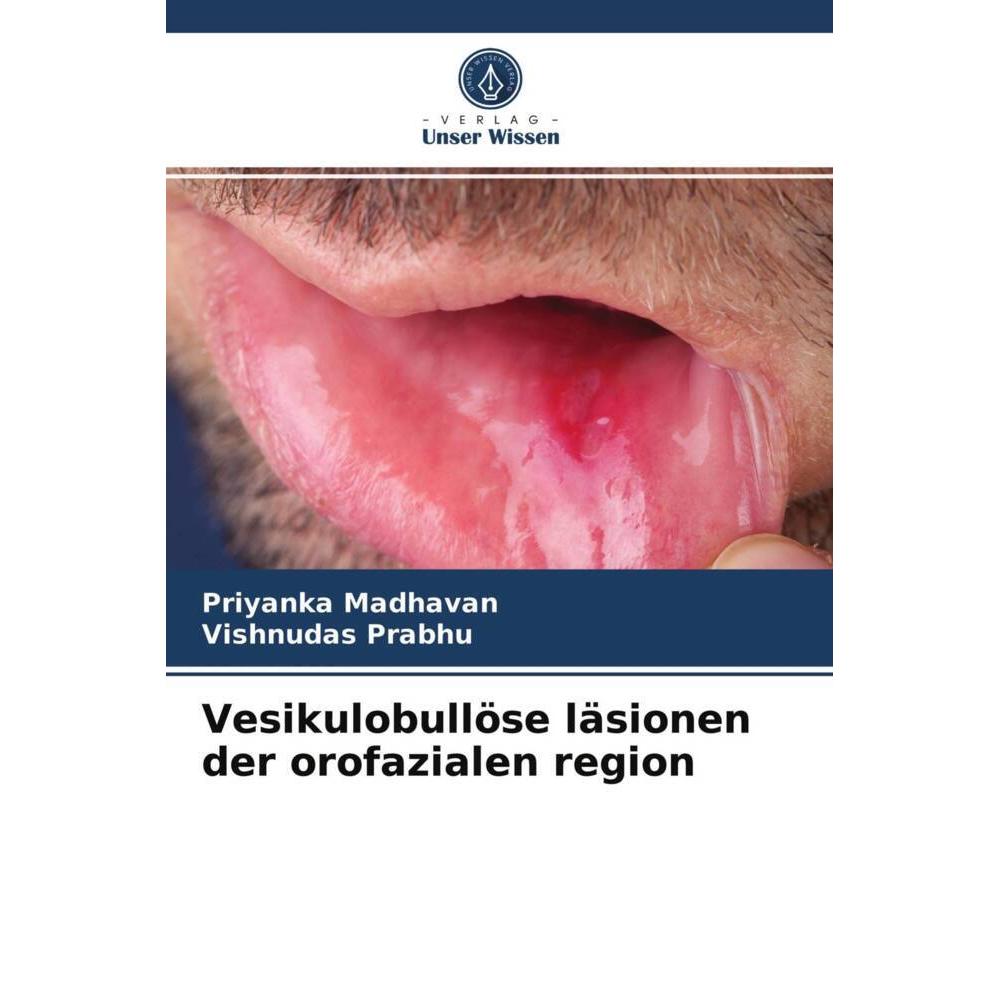 Vesikulobullöse läsionen der orofazialen region, Fachbücher von Priyanka Madhavan, Vishnudas Prabhu