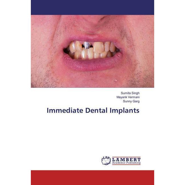 Immediate Dental Implants, Fachbücher von Mayank Vermani, Sunny Garg, Sumita Singh