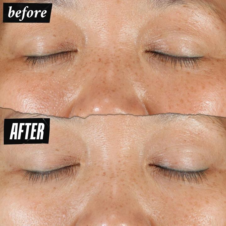 Actual product image Kiehl's Clearly Corrective Dark Spot Solution (100 ml)