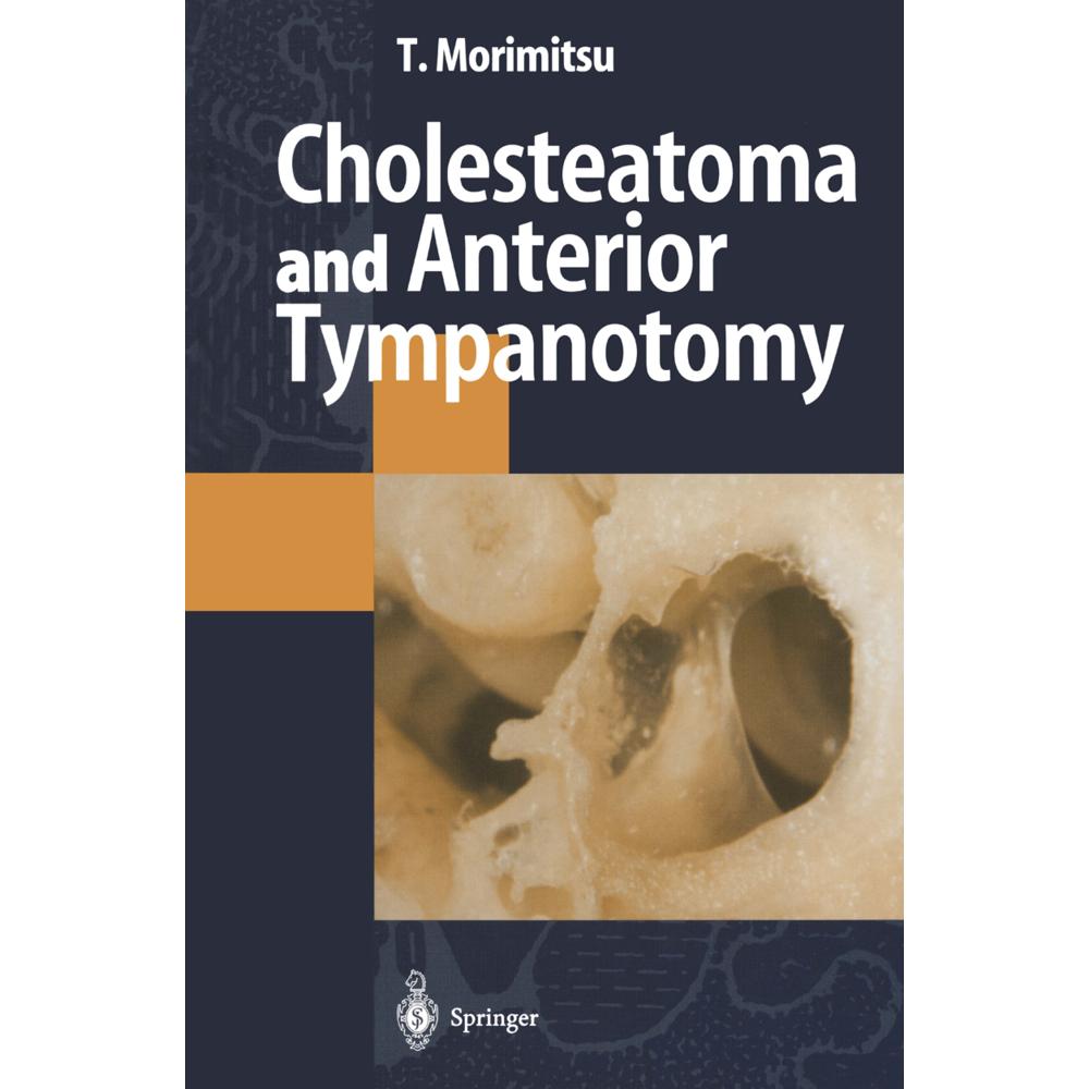 Cholesteatoma and Anterior Tympanotomy, Fachbücher von Tamotsu Morimitsu