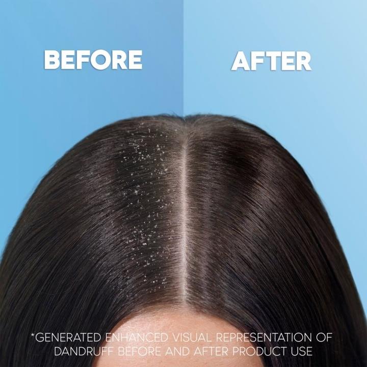 Actual product image Head & Shoulders Extra Volume (400 ml, Liquid shampoo)