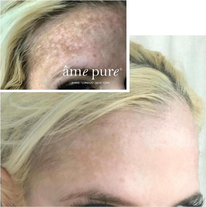 Produktbild Âme pure WrinklEraser™ Basic (30 ml, Gesichtsgel)