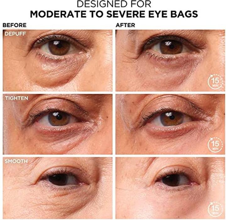 Actual product image It Cosmetics Bye Bye Under Eye Bags (Eye Care Cream, 15 ml, Day)