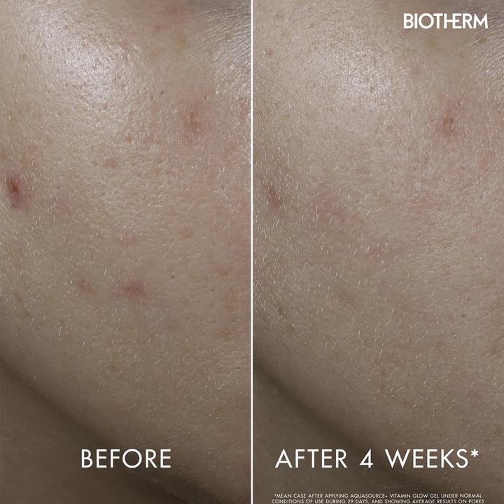 Actual product image Biotherm Aquasource Aquapeel Gel (50 ml, Day cream)