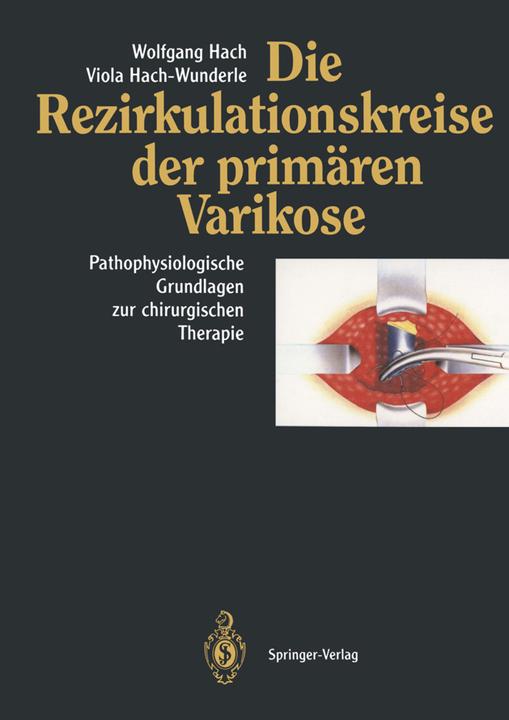 Produktbild Die Rezirkulationskreise der primären Varikose (Deutsch, Viola Hach-Wunderle, Wolfgang Hach, 2012)