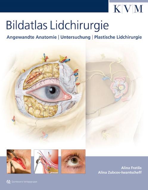Produktbild Bildatlas Lidchirurgie (Deutsch, 2012)