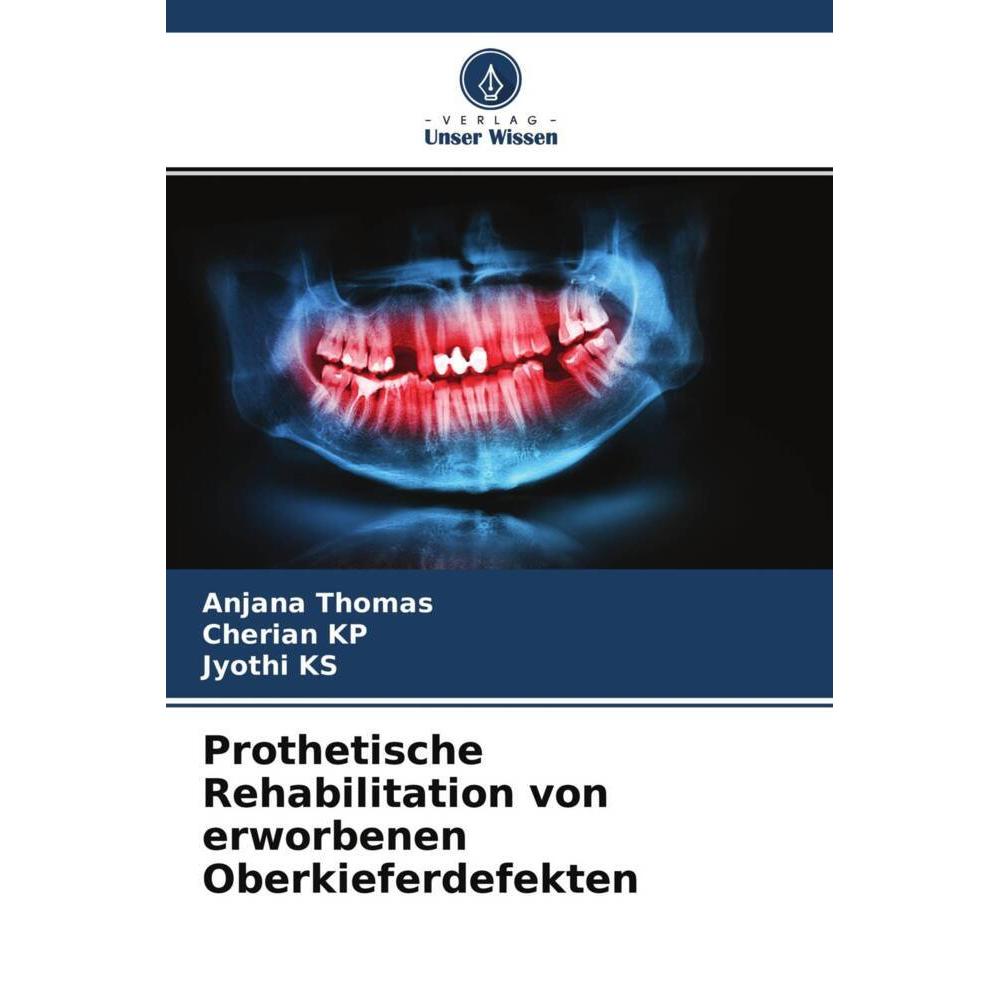 Prothetische Rehabilitation von erworbenen Oberkieferdefekten, Fachbücher von Jyothi KS, Anjana Thomas, Cherian KP