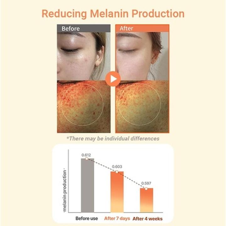 Actual product image Heimish Rx Multi Vitamin Dark Spot Cream - Brightening Cream for Dark Spots (Face mist)