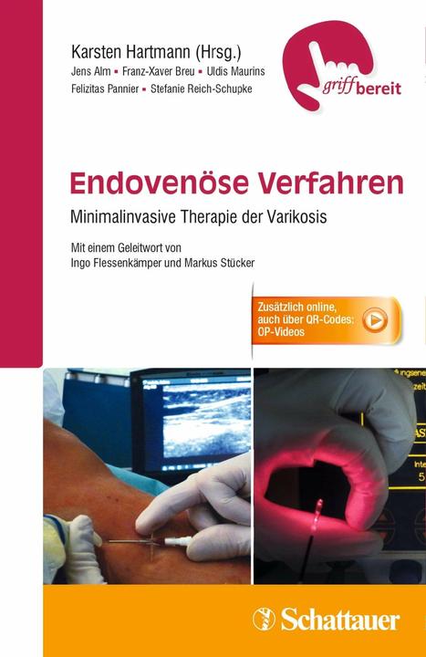 Produktbild Endovenöse Verfahren (Deutsch, Felizitas Pannier, Franz-Xaver Breu, Jens Alm, Karsten Hartmann, Uldis Maurins, 2015)