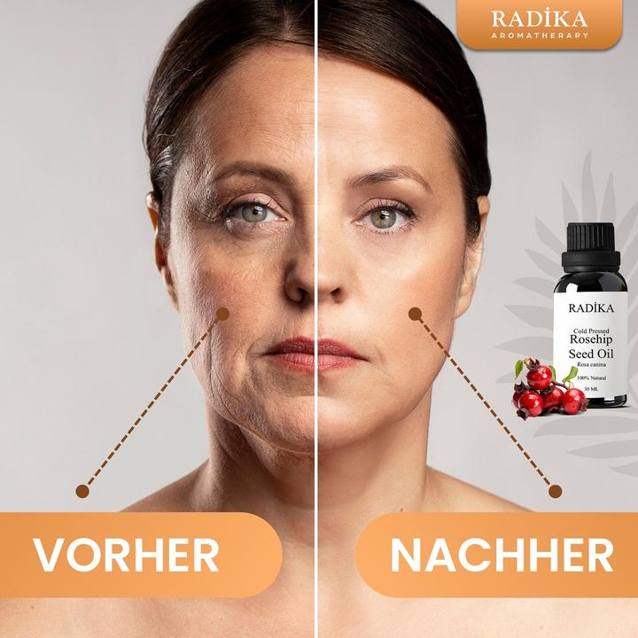 Image du produit Radika Huile de cynorrhodon, pressée à froid, 100% pure, BIO, naturelle, 30 ml (Huile pour le corps, 30 ml)