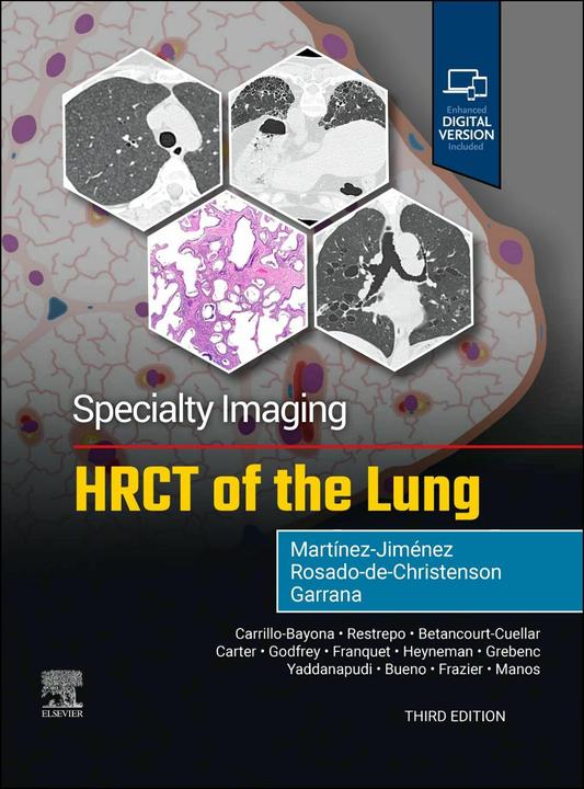 Specialty Imaging: HRCT of the Lung (Englisch, Santiago Martínez-Jiménez, Melissa L. Rosado-de-Christenson, 2025)