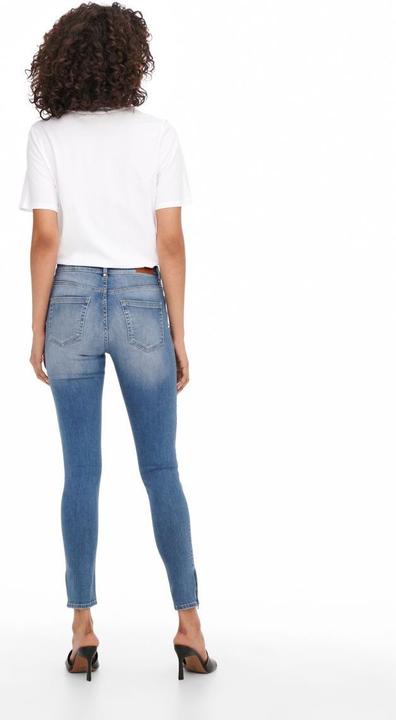 Actual product image Only ONLBlush Mid Ankle Skinny Fit Jeans (32)