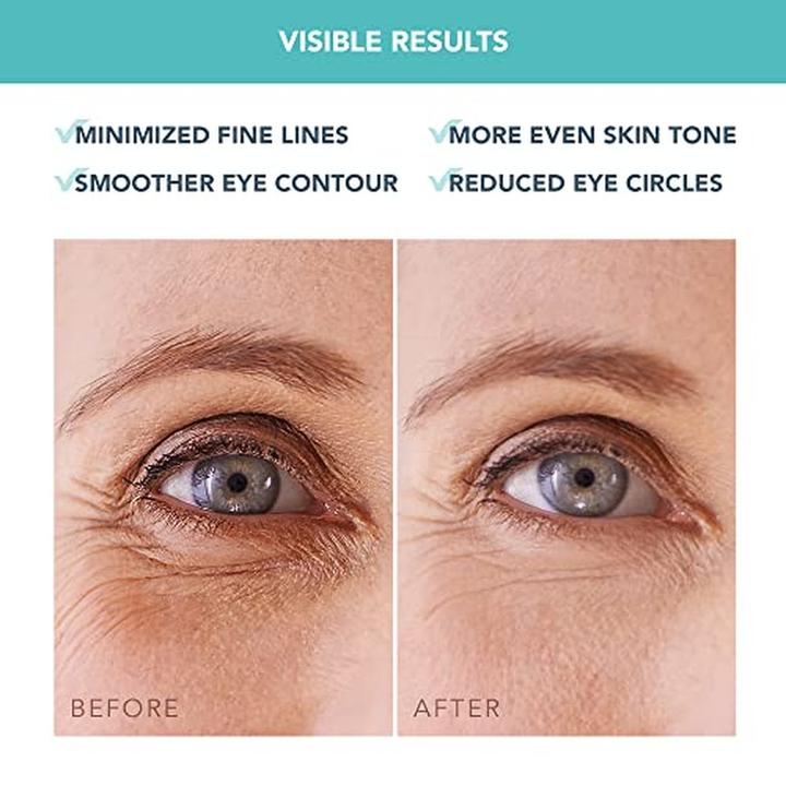 Immagine prodotto Foreo Maschera per gli occhi Hydra hydrogel IRISâ"¢ (Maschera per gli occhi) 60 pezzi (Gel per la cura degli occhi, Giorno + Notte)