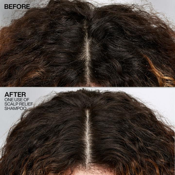 Actual product image Redken Scalp Relief Dandruff Control (250 ml, Liquid shampoo)