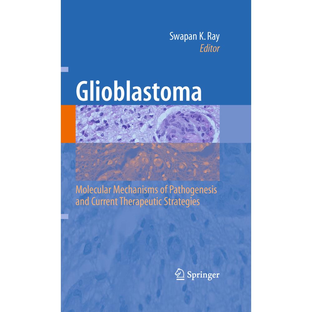 Glioblastoma:, Fachbücher von Swapan K. Ray