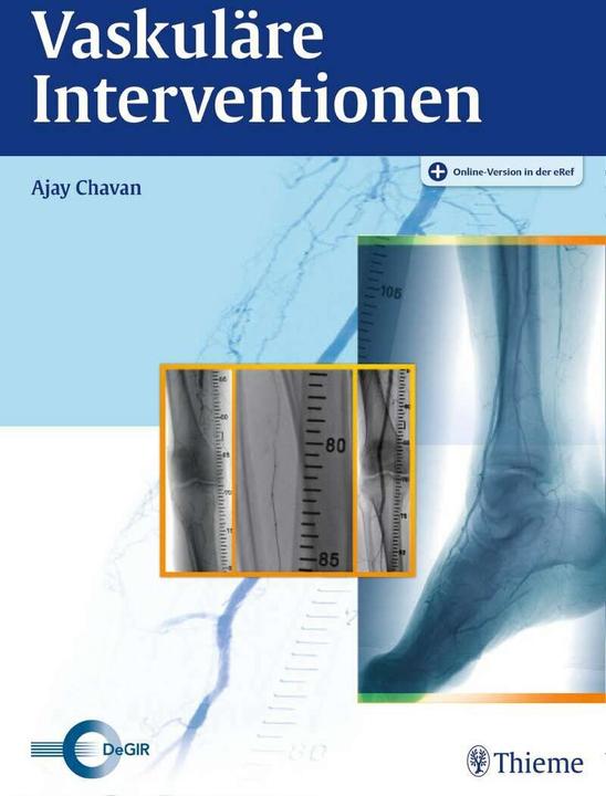 Produktbild Vaskuläre Interventionen (Deutsch, Ajay Chavan, 2016)