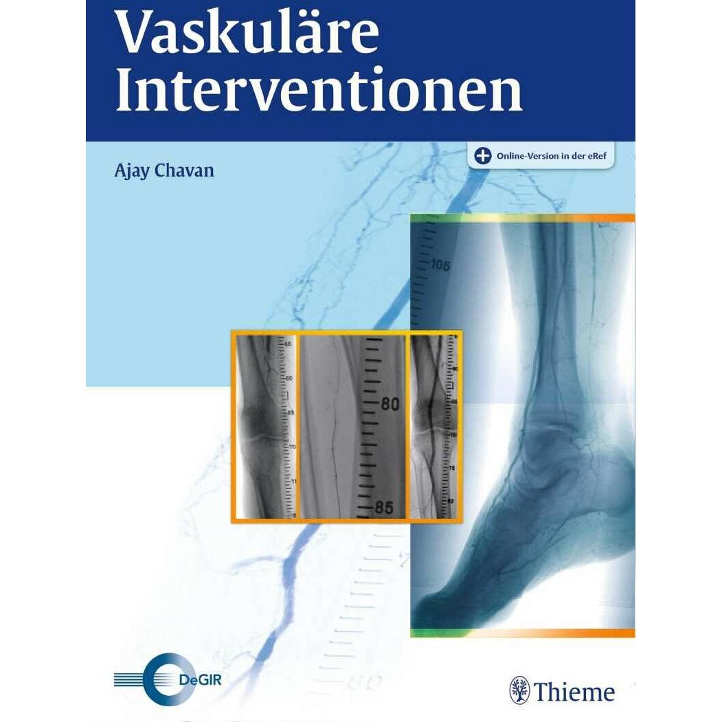 Vaskuläre Interventionen, Fachbücher von Ajay Chavan