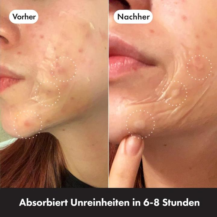 Produktbild Hero.Mighty Patch Surface (206.64 ml)