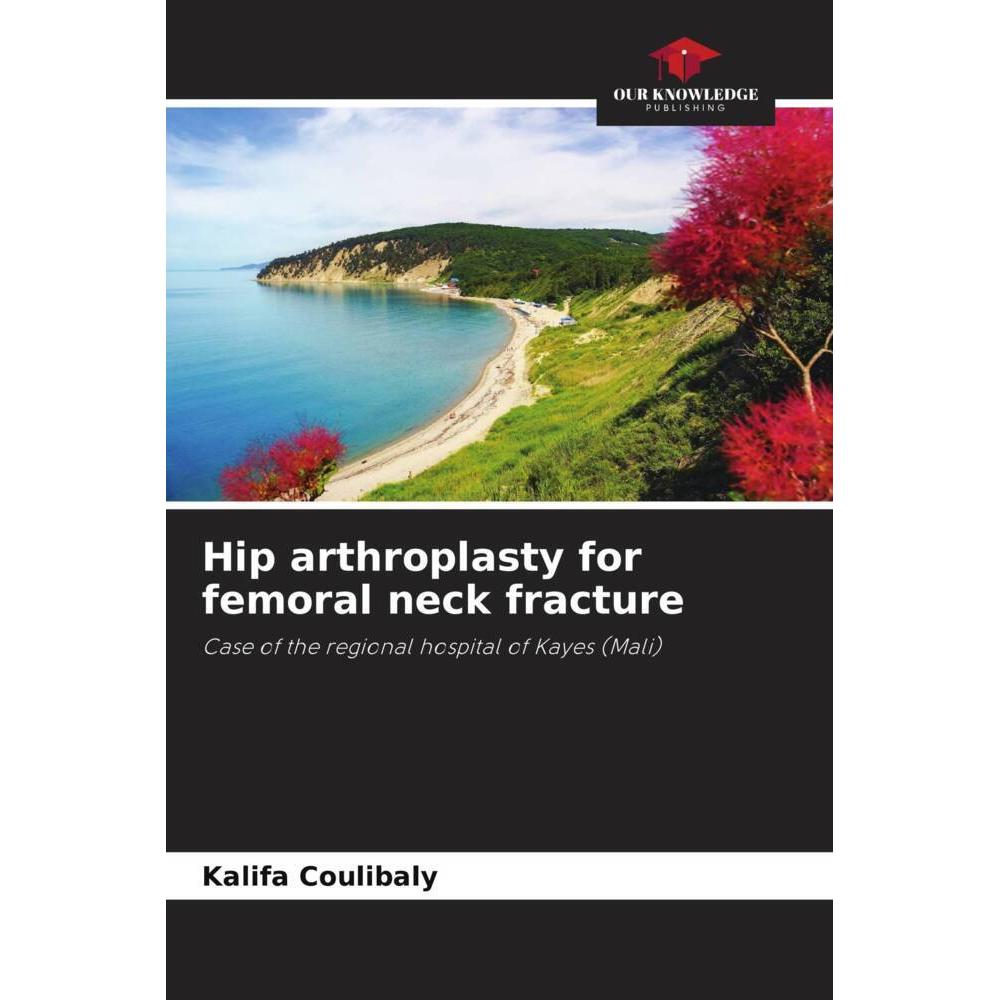 Hip arthroplasty for femoral neck fracture, Fachbücher von Kalifa Coulibaly