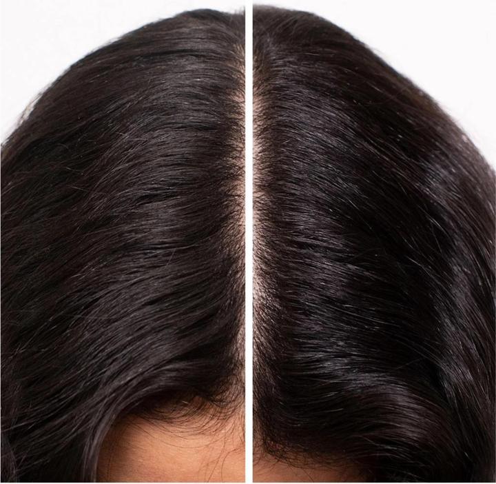 Produktbild Shu Uemura Essence Absolue Nourishing Soothing Scalp Oil Concentrate (50 ml)