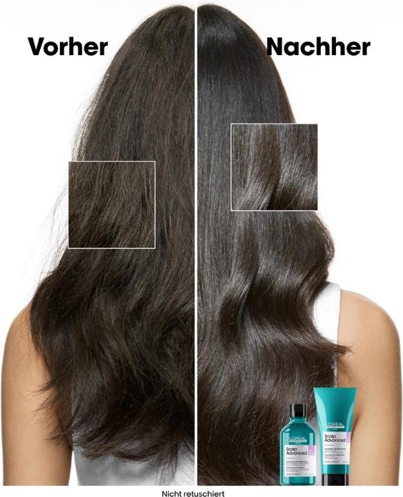 Produktbild L'Oréal Professionnel Série Expert Scalp Advanced - Anti-Discomfort Dermo-Regulator (300 ml, Flüssiges Shampoo)