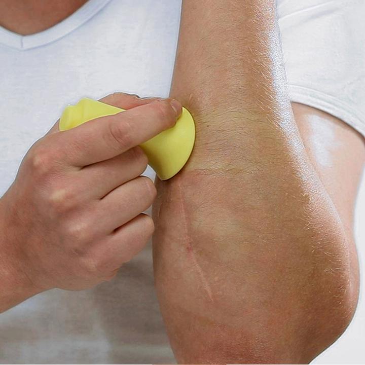 Actual product image BellaBambi Cupping Suction Original