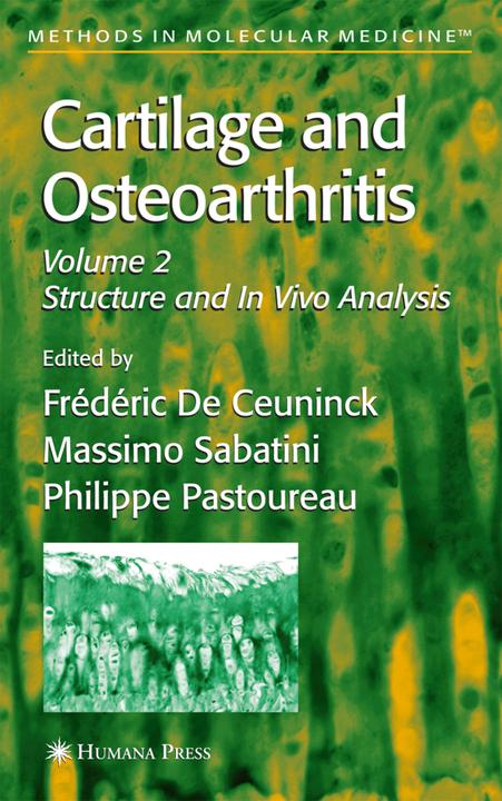 Produktbild Cartilage and Osteoarthritis (Englisch, Frédéric De Ceuninck, Massimo Sabatini, Philippe Pastoureau, 2010)