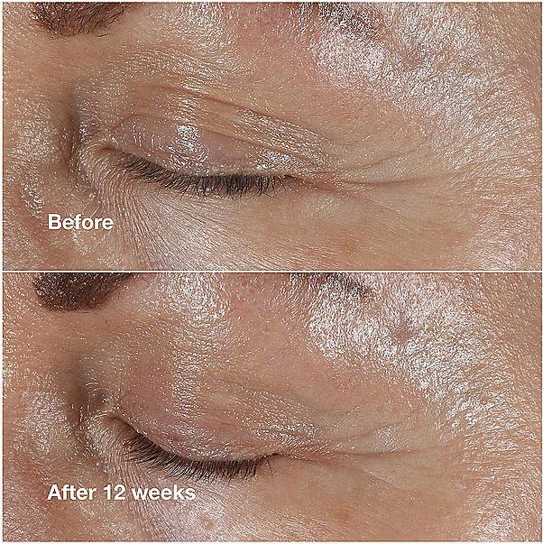 Immagine prodotto Clinique Smart Clinical Repair Wrinkle Correcting Eye Cream (Crema per la cura degli occhi, 30 ml, Giorno + Notte)