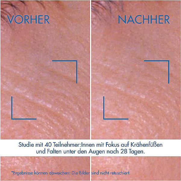 Actual product image Biotherm Pro-Retinol (Eye Care Cream, Day + Night, 15 ml)