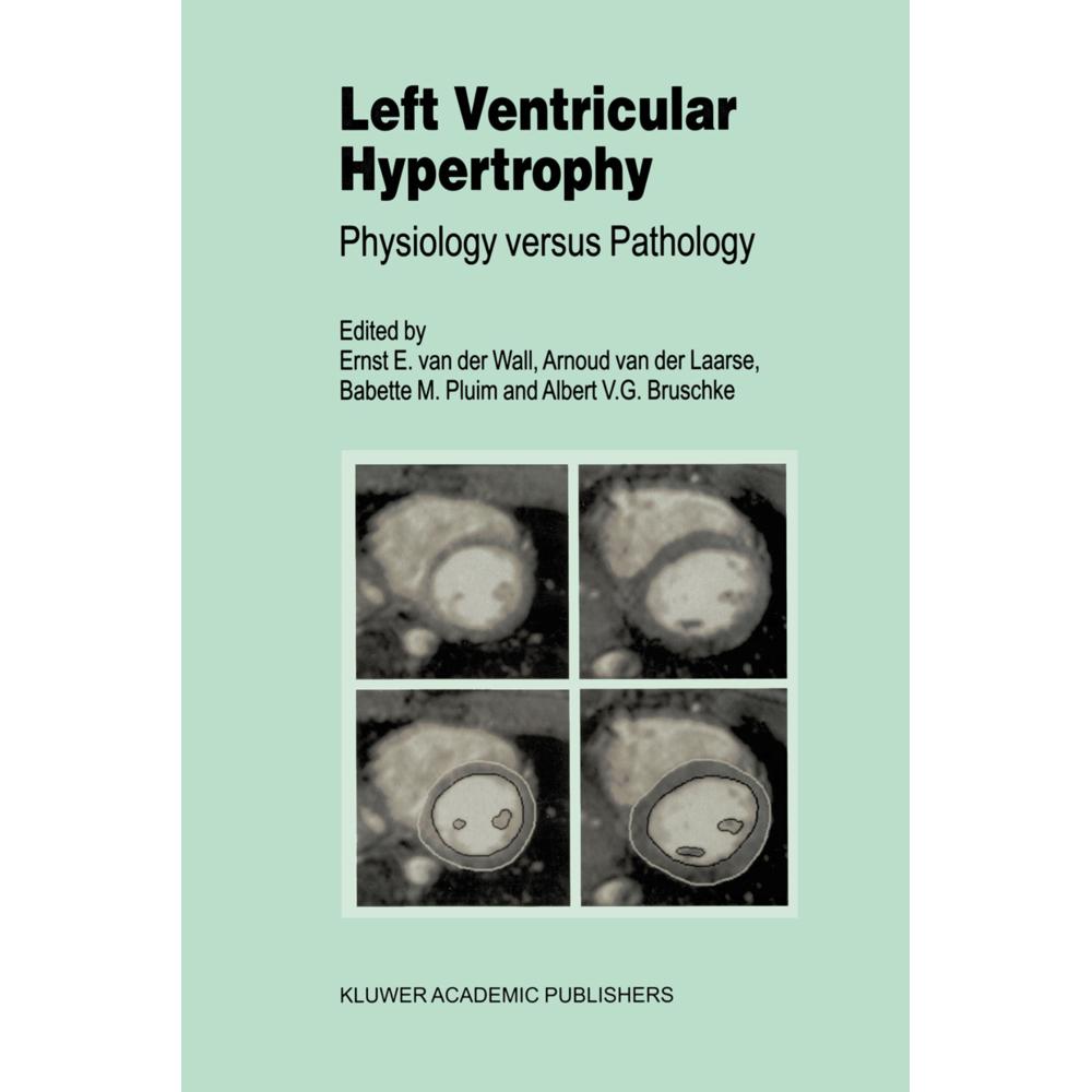 Left Ventricular Hypertrophy, Fachbücher von Ernst E. van der Wall, A. V. Bruschke, Babette M. Pluim, Arnoud van der Laa...