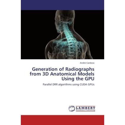 Generation of Radiographs from 3D Anatomical Models Using the GPU, Fachbücher von André Cardoso