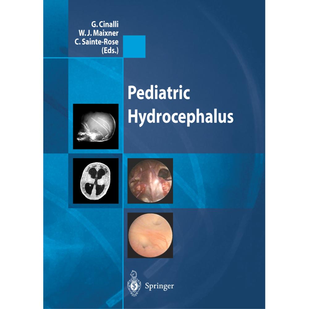 Pediatric Hydrocephalus, Fachbücher