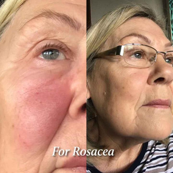 Actual product image Eco by Sonya Glory Oil (30 ml, Face oil)