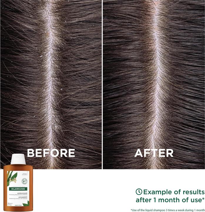 Produktbild Klorane Anti-Schuppen Shampoo mit Galanga (200 ml, Flüssiges Shampoo)