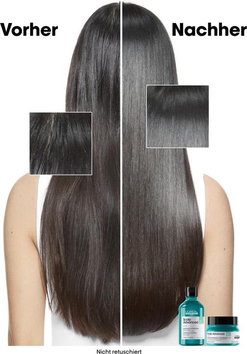 Immagine prodotto L'Oréal Professionnel Série Expert Scalp Advanced - Dermo-Purificatore Anti-Oiliness (300 ml, Shampoo liquido)