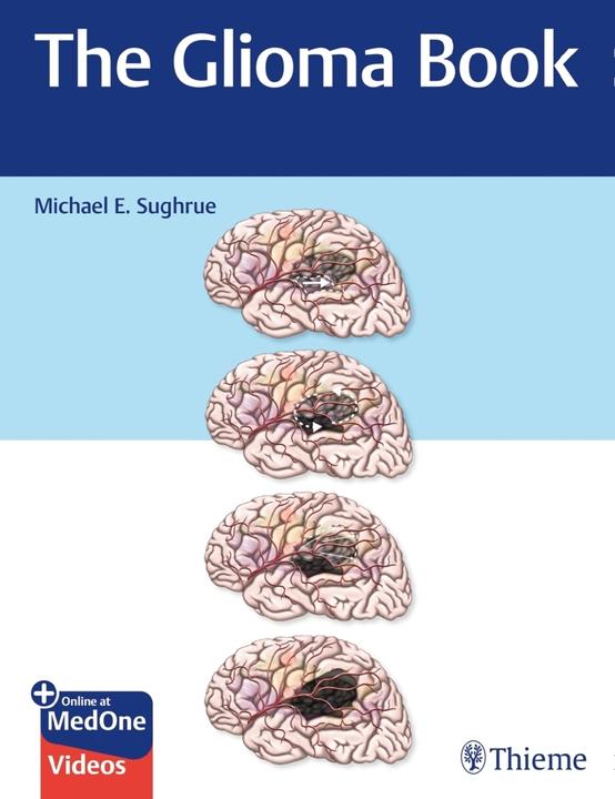Actual product image Sughrue:The Glioma Book (English, Michael E. Sughrue, 2020)
