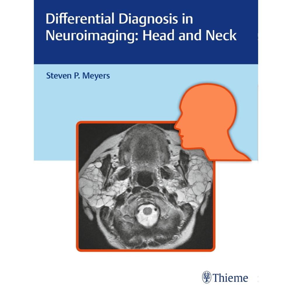 Thieme, Stuttgart, Praxisbedarf, Diff.Diagn.Neuroimaging - Head a.Neck
