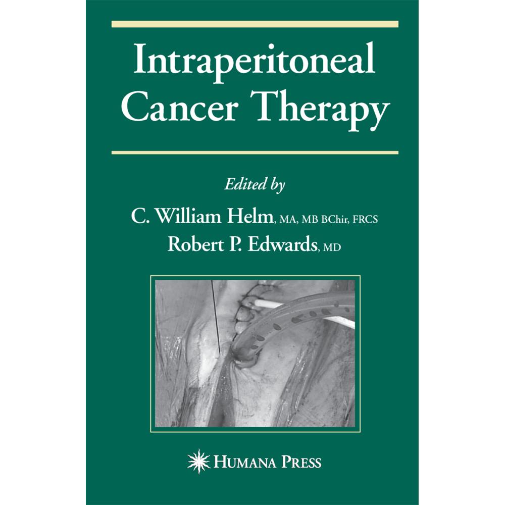 Intraperitoneal Cancer Therapy, Fachbücher von Robert Edwards, C. William Helm