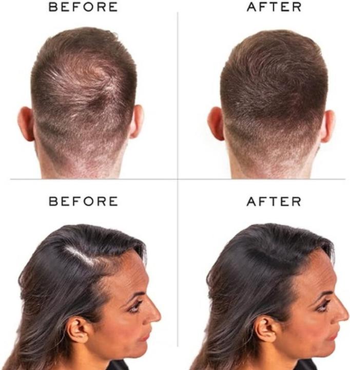 Produktbild Nanogen Nanofibres Hellblond (Hellblond)