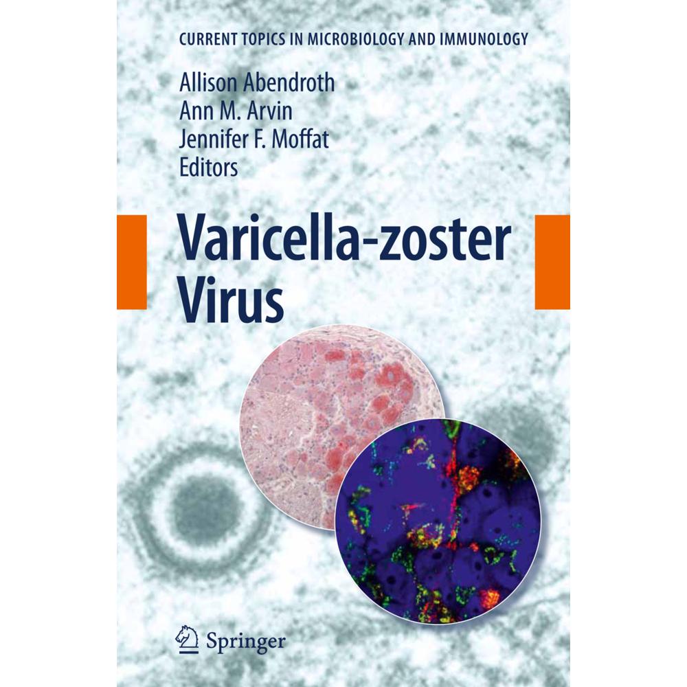 Varicella-zoster Virus, Fachbücher von Ann M. Arvin, Allison Abendroth, Jennifer F. Moffat