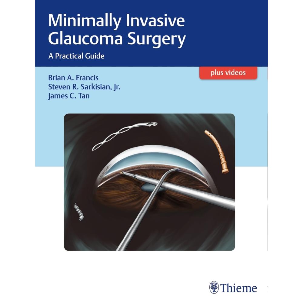 Francis, Minimally Invasive Glaucoma, Fachbücher von Steven Sarkisian, Brian Francis, James C. Tan