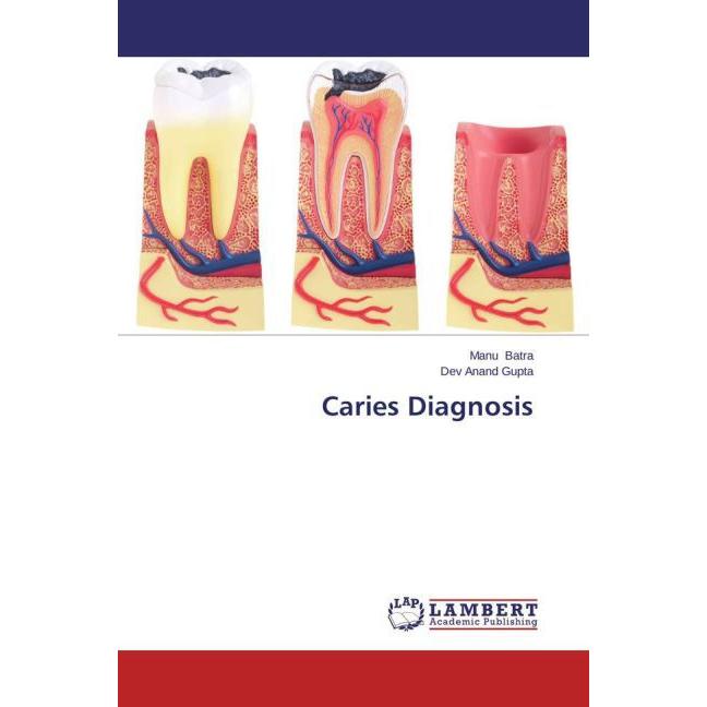 Caries Diagnosis, Fachbücher von Dev Anand Gupta, Manu Batra