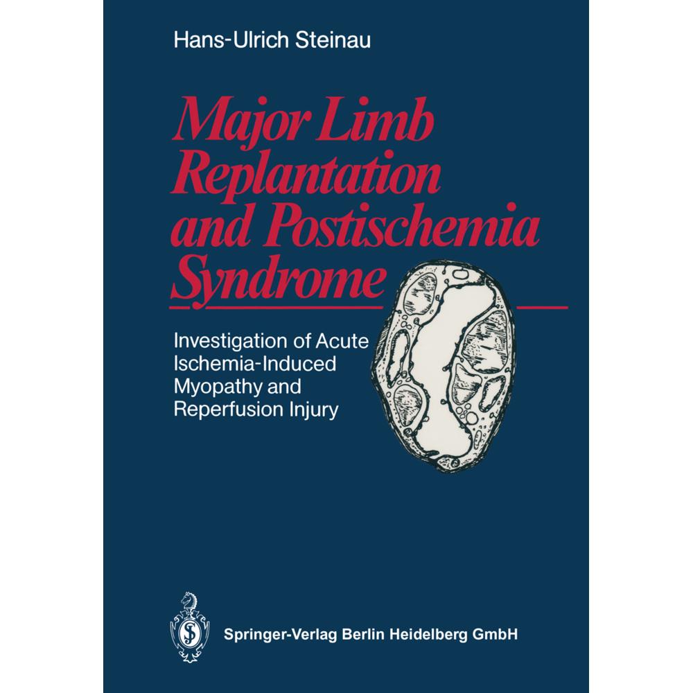 Major Limb Replantation and Postischemia Syndrome, Fachbücher