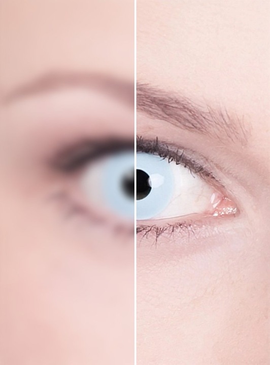 Actual product image Metamorph Hellblau mit Dioptrien (Light blue)