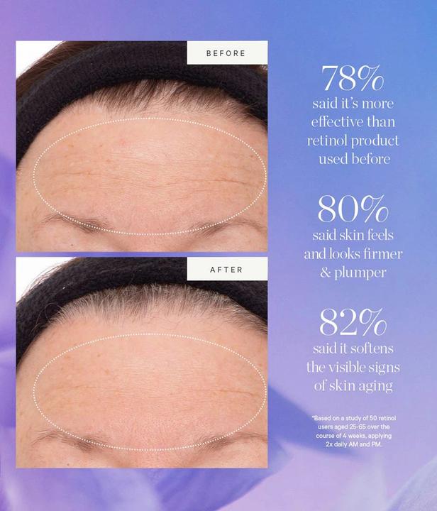 Actual product image Kora Organics - Plant Stem Cell Retinol Alternative Serum 10 ml (10 ml)