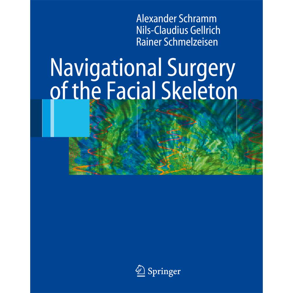 Navigational Surgery of the Facial Skeleton, Fachbücher von Rainer Schmelzeisen, Nils-Claudius Gellrich, Alexander Schra...