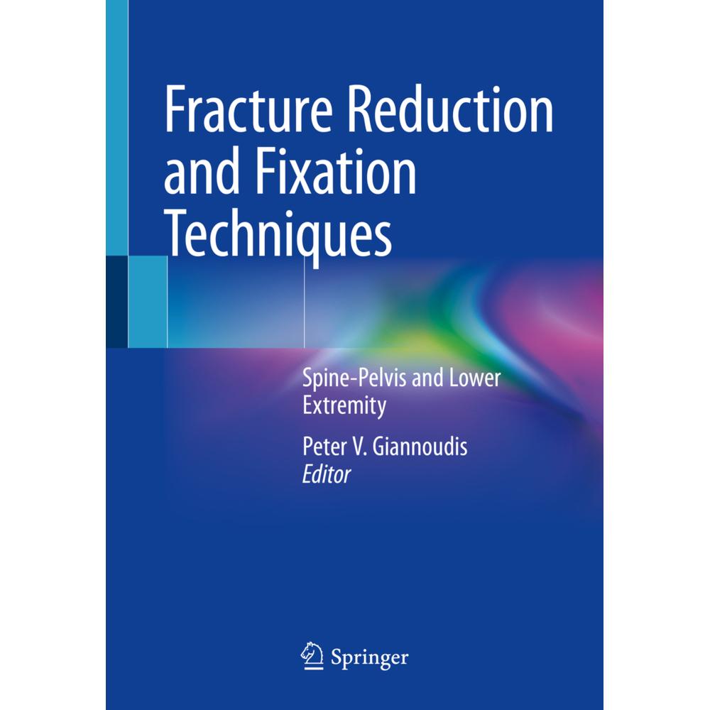 Fracture Reduction and Fixation Techniques, Fachbücher von Peter V. Giannoudis