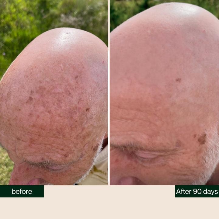 Immagine prodotto Better be bold Olio per barba e olio per calvizie (30 ml)