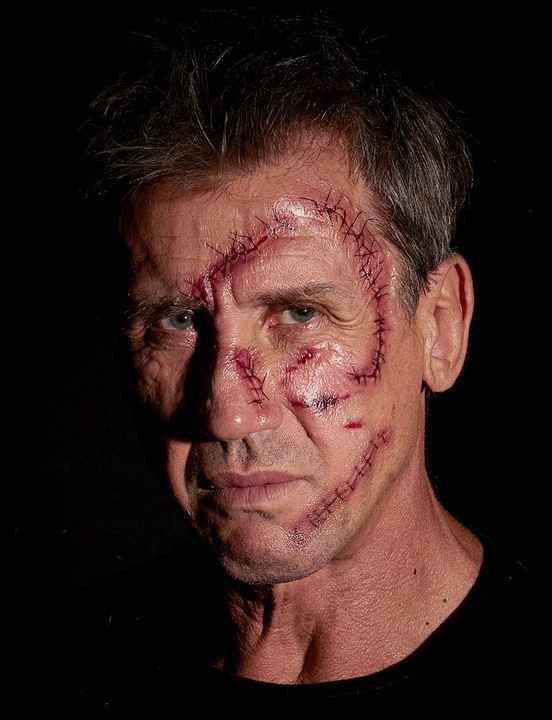Actual product image Widmann Stitched wound